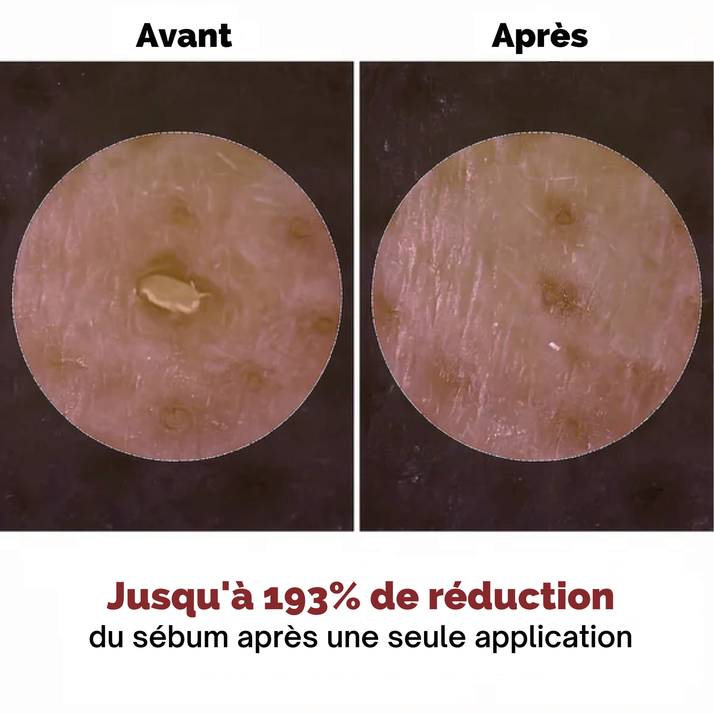 Satineva® | Peel Shot coréen – Élimine les impuretés et sublime la peau