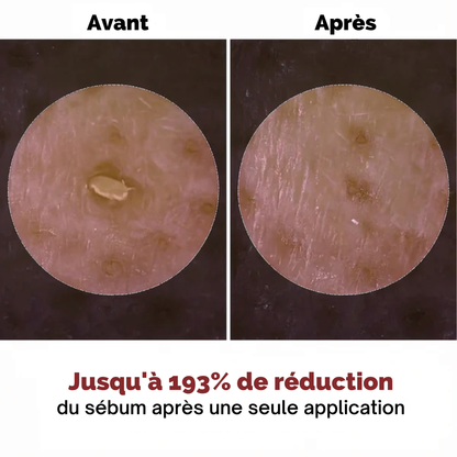 Satineva® | Peel Shot coréen – Élimine les impuretés et sublime la peau