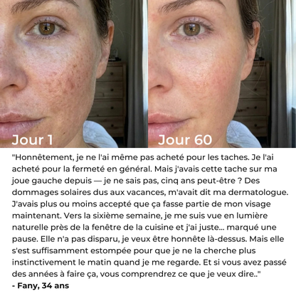 LiftLED Facial Pro 7-en-1 Satineva