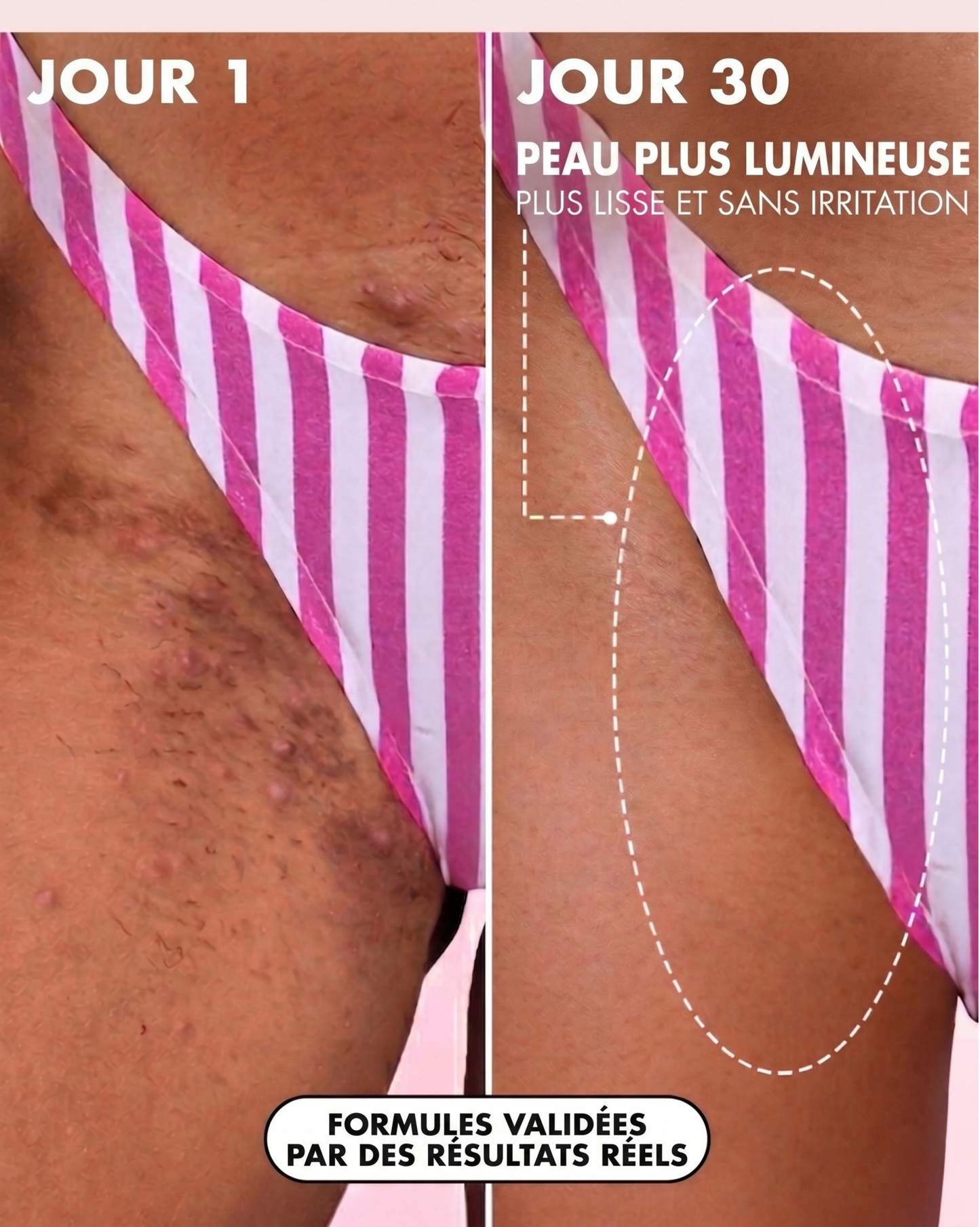 Satin Glow™ - Huile Régénérante Post-Épilation