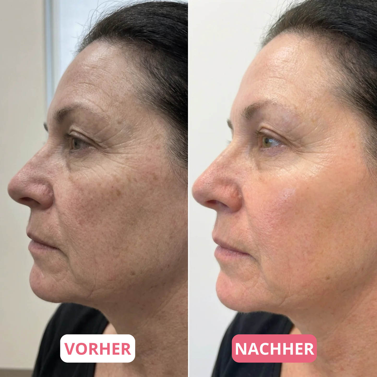 Anti-Aging Bio-Kollagen Maske