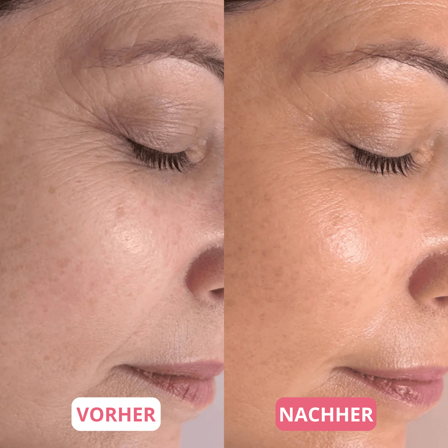 Anti-Aging Bio-Kollagen Maske