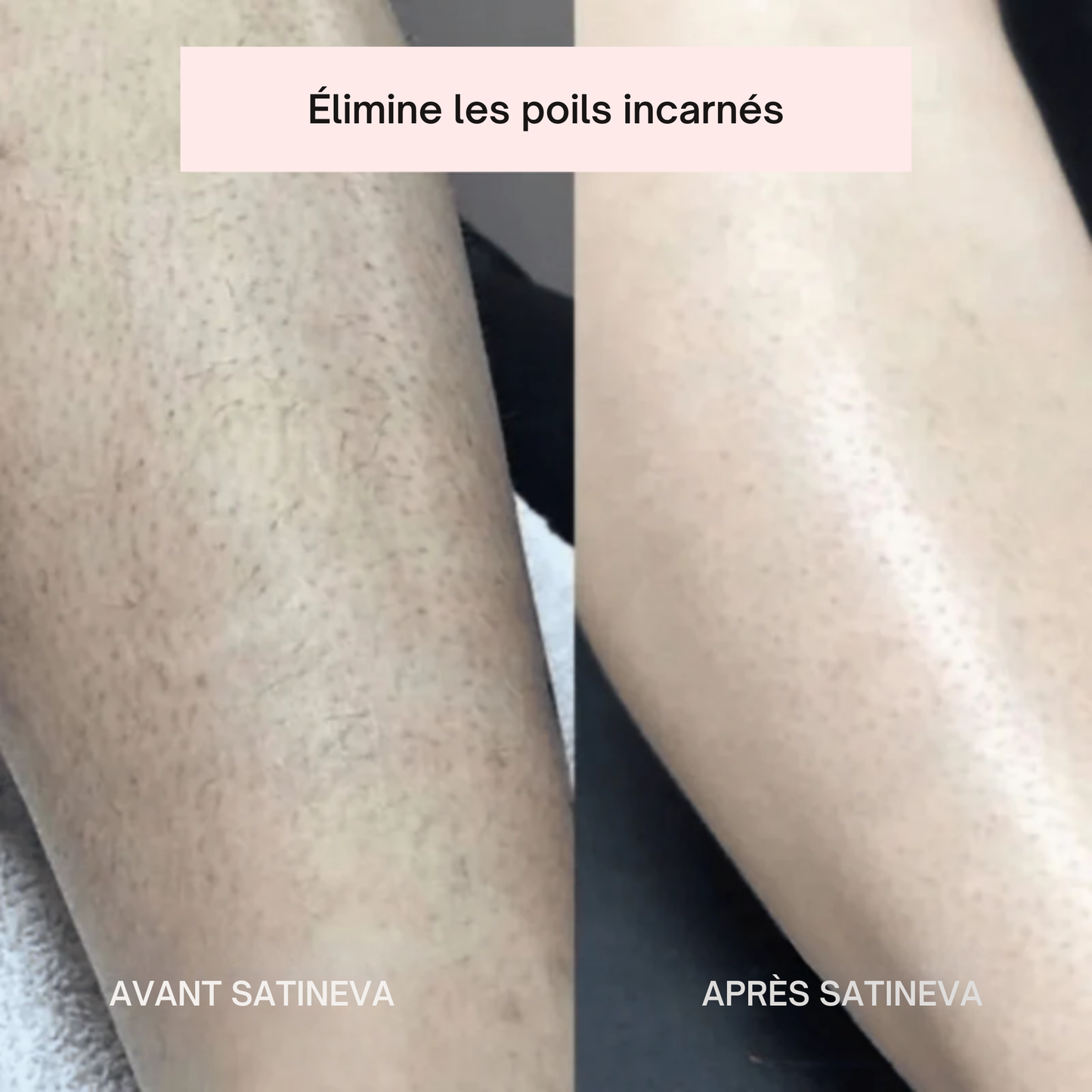 SATINEVA® PRO • Rasoir 2-en-1 électrique intime