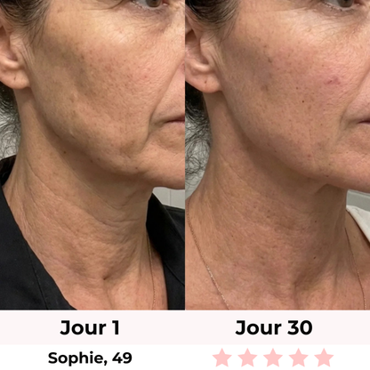 LiftLED Facial Pro 7-en-1 Satineva