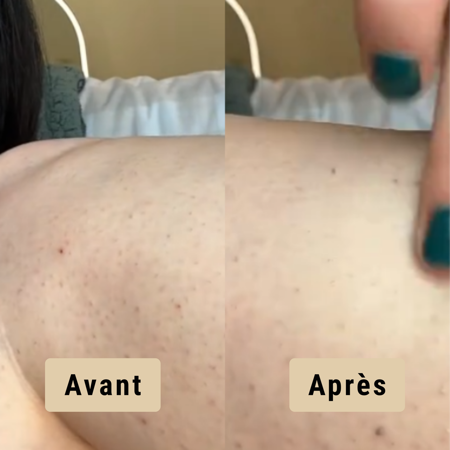 Satineva® | Peel Shot coréen – Élimine les impuretés et sublime la peau
