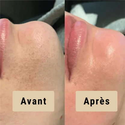 Satineva® | Peel Shot coréen – Élimine les impuretés et sublime la peau