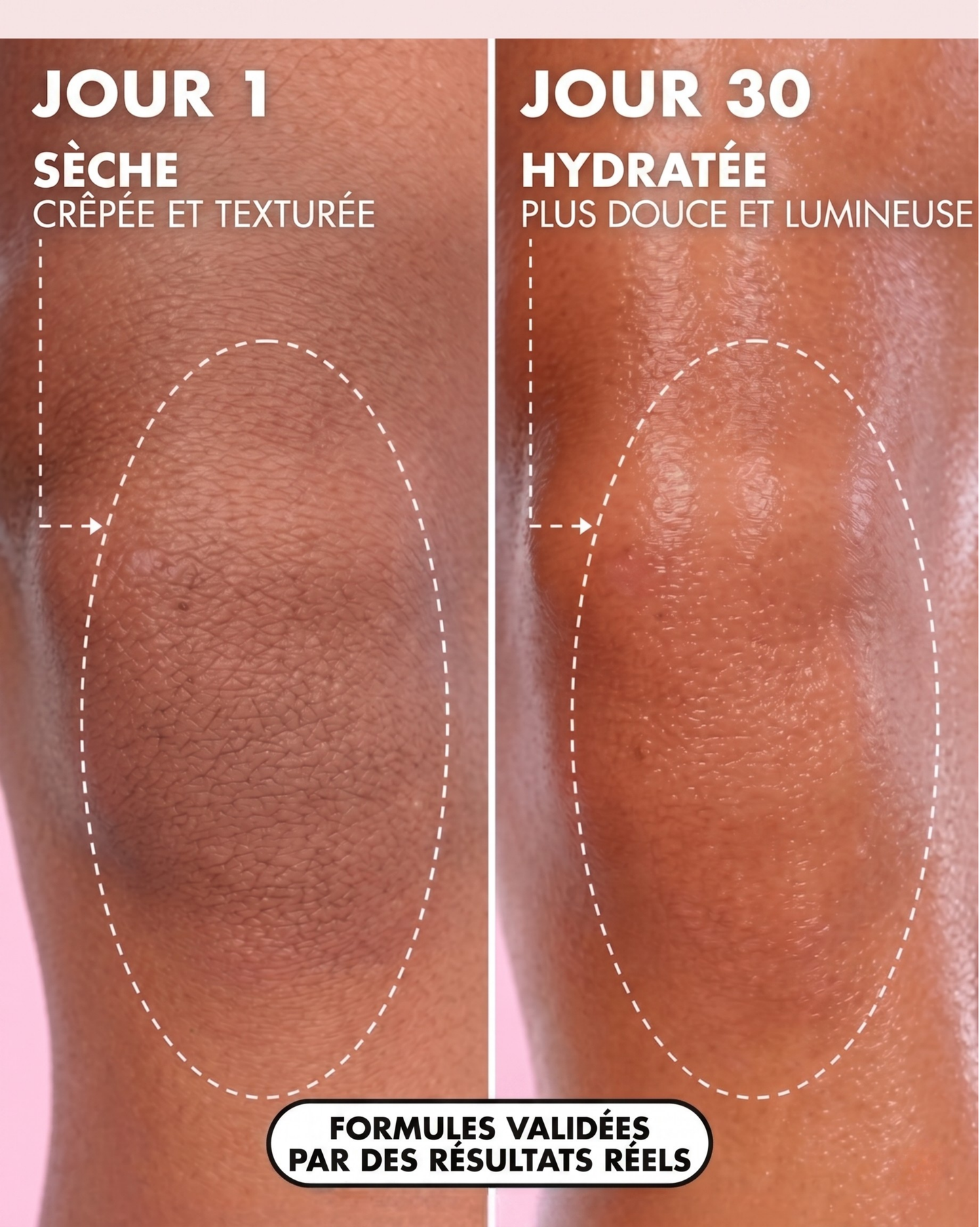 Satin Glow™ - Huile Régénérante Post-Épilation