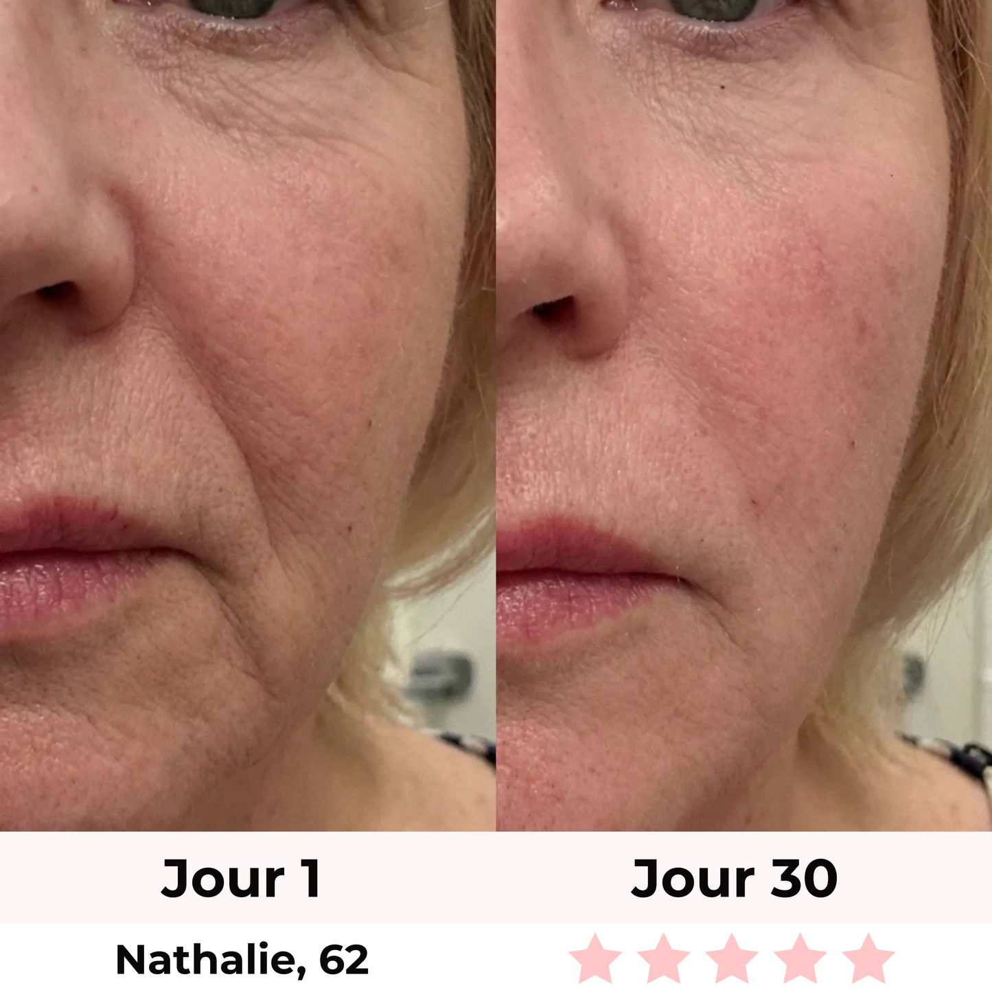 LiftLED Facial Pro 7-en-1 Satineva