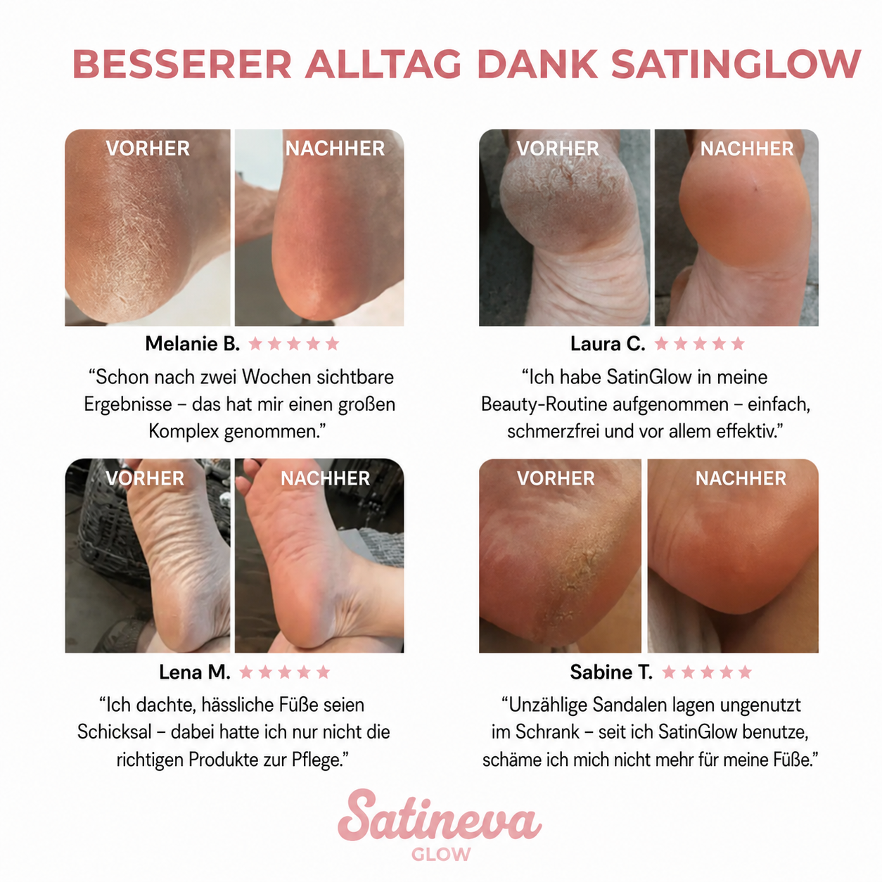 ✨ SatinGlow™ – Fußpflege-Set