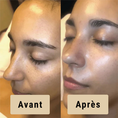 Satineva® | Peel Shot coréen – Élimine les impuretés et sublime la peau