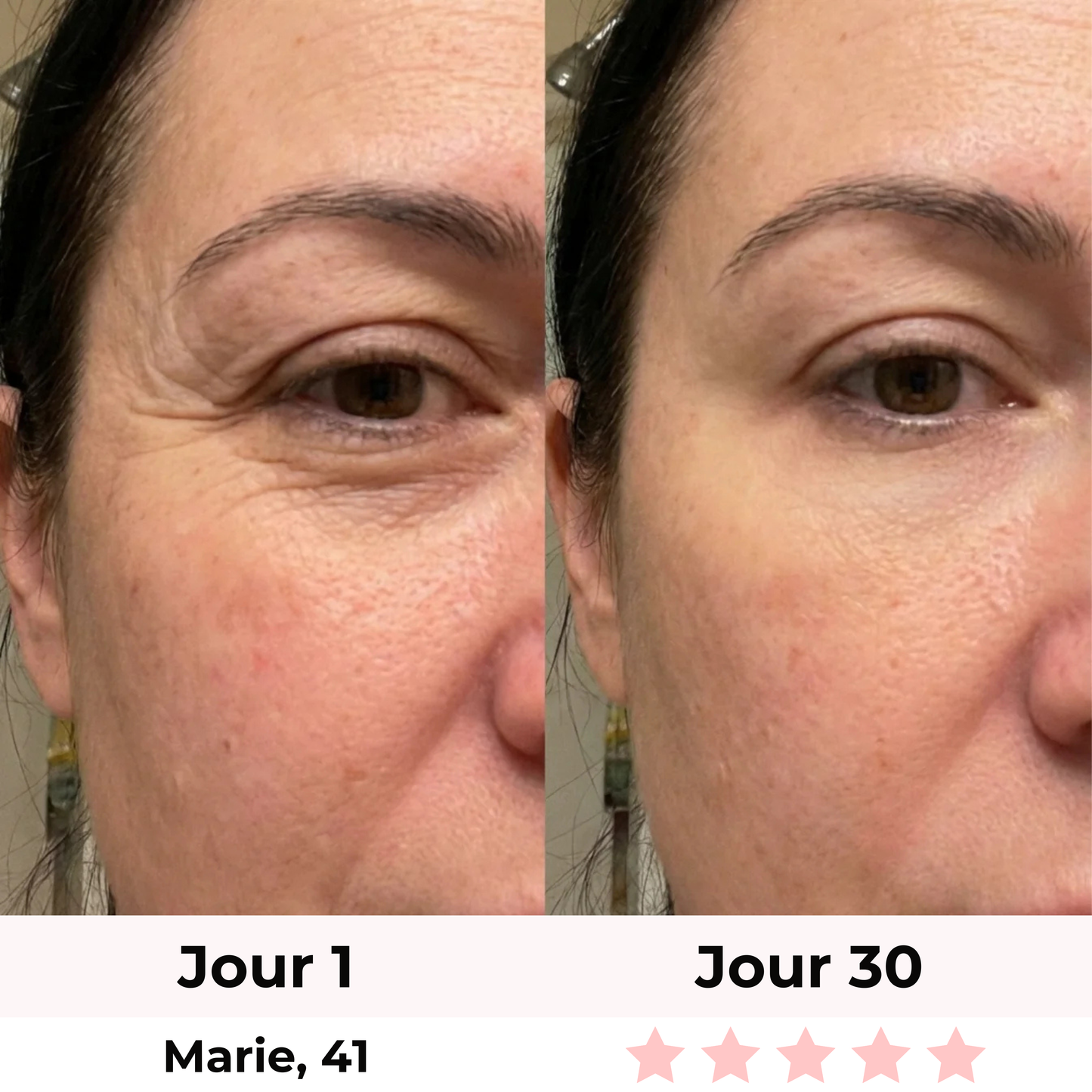 LiftLED Facial Pro 7-en-1 Satineva
