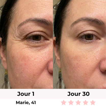 LiftLED Facial Pro 7-en-1 Satineva