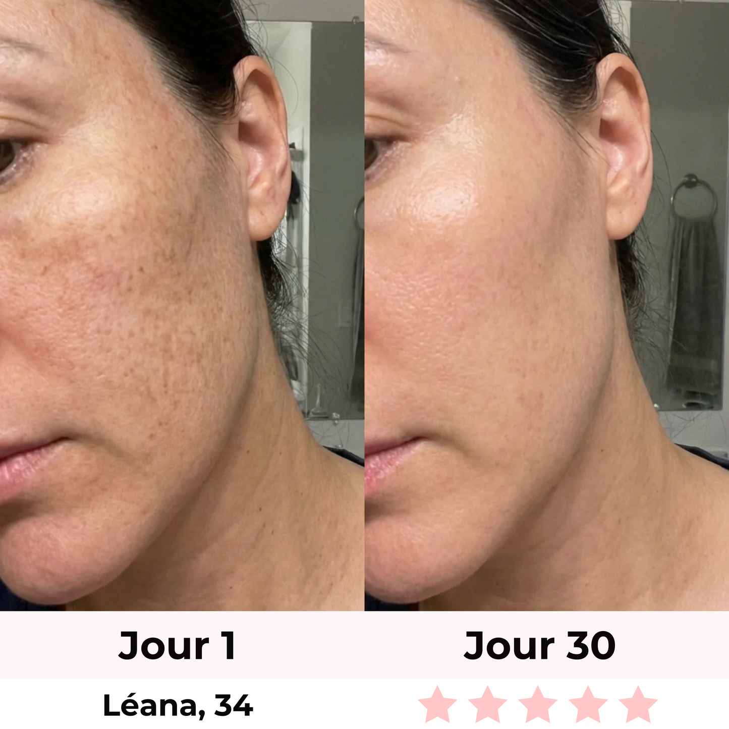LiftLED Facial Pro 7-en-1 Satineva