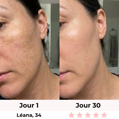 LiftLED Facial Pro 7-en-1 Satineva